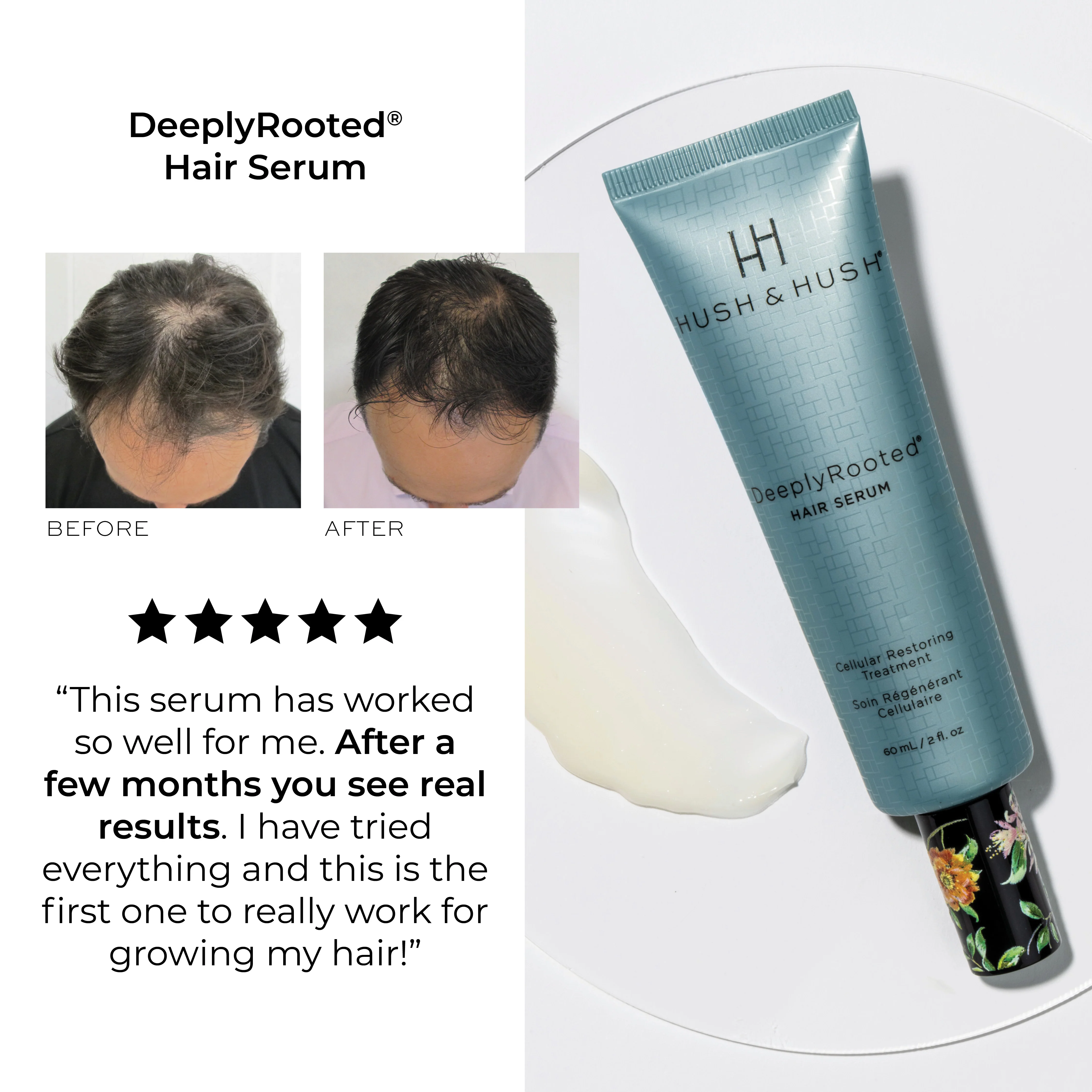 DeeplyRooted Hair Serum - Image 5